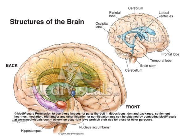 Powerful Brain Injury Medical Legal Exhibits | Severe Head Trauma