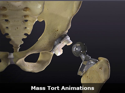 Mass Tort Animations
