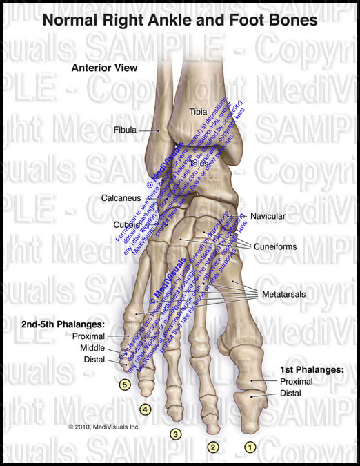 Anterior view of the foot showing the peek-a-boo sign in detail on