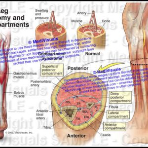 Arteries of the Left Leg - Trial Exhibits Inc.