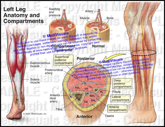 Anatomy And Compartments Of The Left Leg Compartment Syndrome Medivisuals Inc