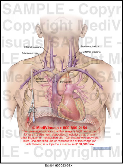 Anatomy of the Chest - Trial Exhibits Inc.