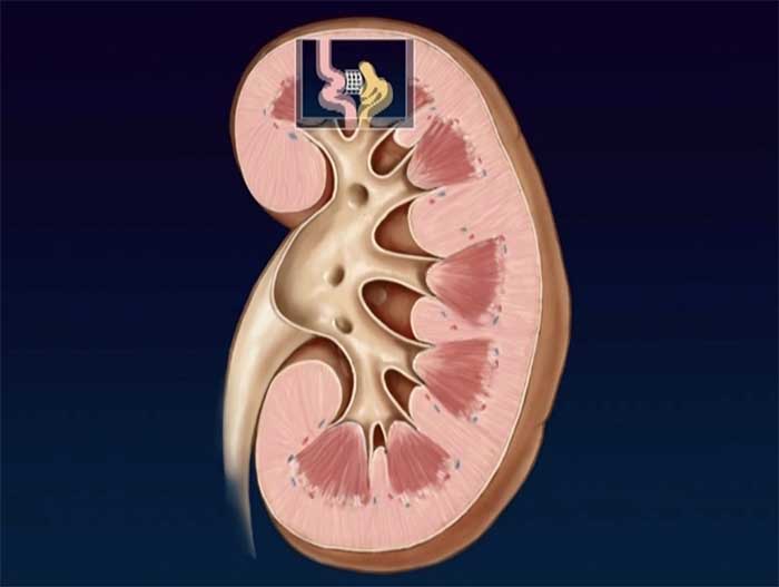 Normal Kidney Function -part 2-Filtration of Contrast by the Normal Kidney  | Medivisuals Inc.